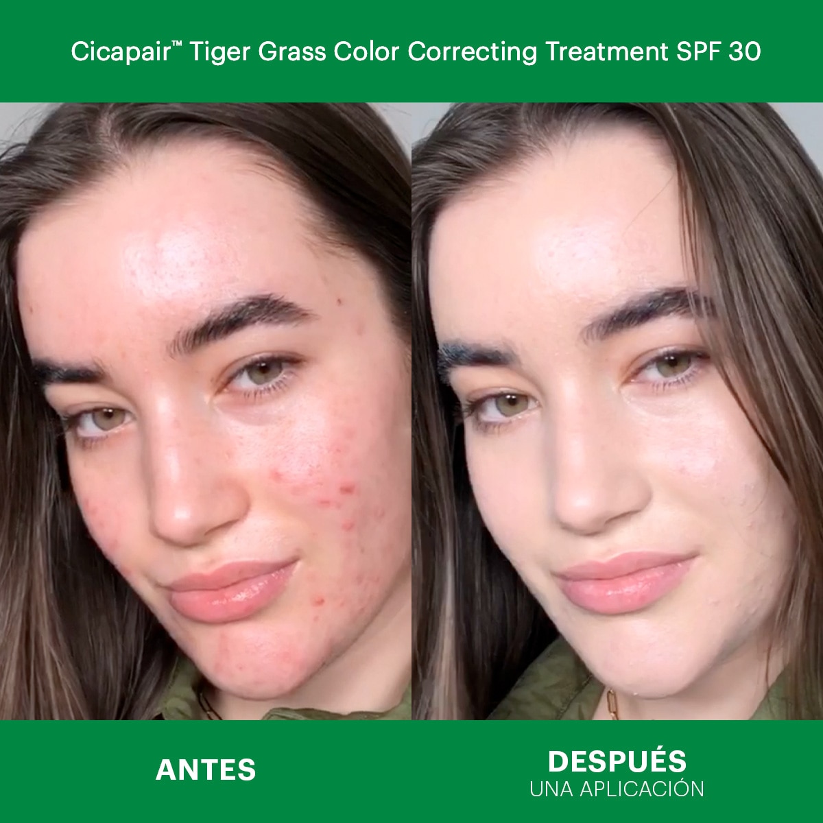 CICAPAIR™ REDNESS RESCUE KIT (SET PARA CUIDADO DE LA PIEL)